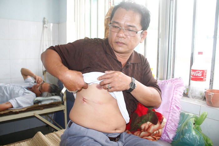 Ông Hồ Tăng, phó trưởng công an xã Tâm Xuân 1 và vết thương ở hông đang chữa trị tại BV Đa khoa Quảng Nam 