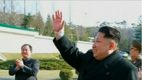 Lộ hình ảnh Kim Jong-un bị thương ở cổ tay