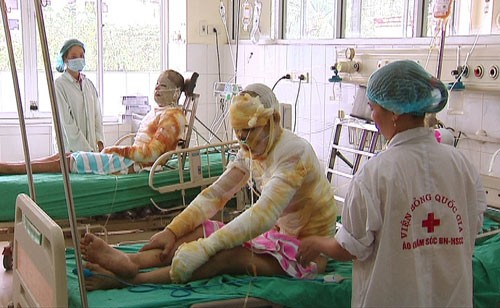 Các nhân đang điều trị tại khoa Cấp cứu, Bệnh viện Bỏng Quốc gia. Ảnh: Hà An/ VnExpress