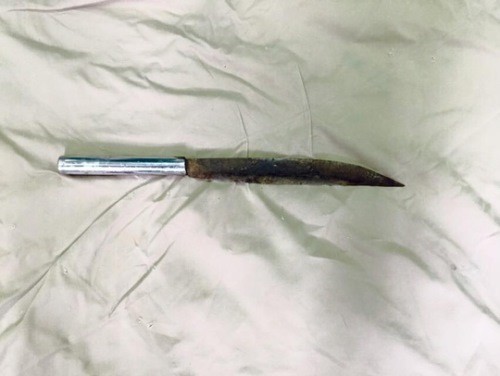 Con dao dài khoảng 20 cm đâm trúng đầu người phụ nữ. Ảnh: Bác sĩ cung cấp