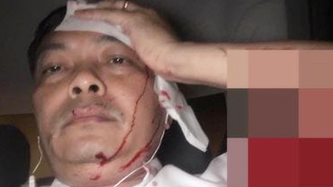 Ông Nguyễn Văn Đông ôm đầu tóe máu do bị tấn công.