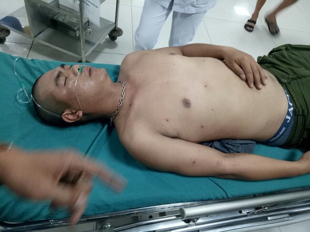 Anh Tiến bị thương phải đi cấp cứu tại Bệnh viện Hữu nghị Việt Nam - Cu Ba Đồng Hới. (Ảnh C.H)