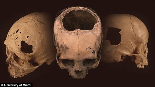 Phát hiện mới ở Peru tiết lộ khả năng phẫu thuật sọ của người Inca