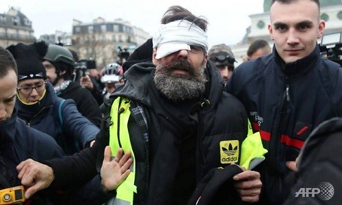 Jerome Rodrigues bị thương ở mắt trong cuộc biểu tình ngày 27/1. Ảnh: AFP