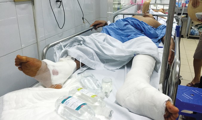 Bệnh nhân Trần Văn Thảo sau khi bị mổ nhầm chân. Ảnh: Thái Hà.