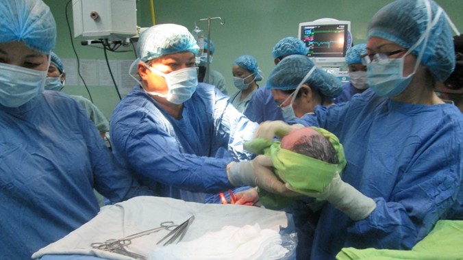  Em bé ra đời bằng thụ tinh trong ống nghiệm đầu tiên được đưa ra khỏi bụng mẹ. Ảnh: Thanh Trần