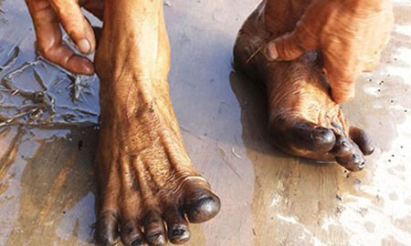 TPHCM yêu cầu làm rõ vụ dân lội ruộng chân bị nhuộm đen