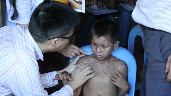 Bác sĩ khám cho trẻ bị bệnh viêm da sắc tố tại Phú Thọ