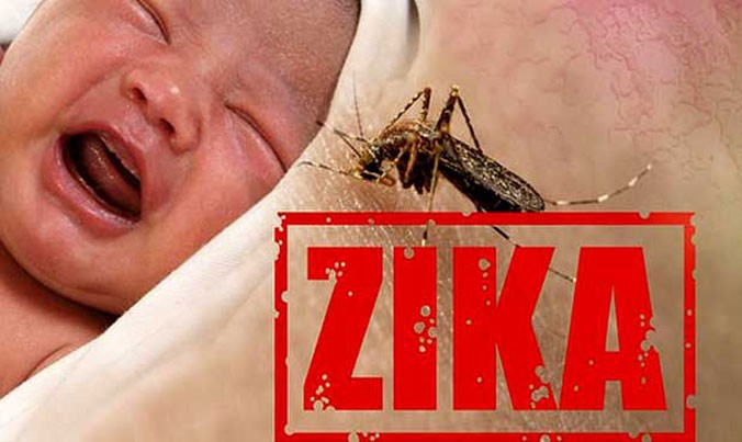 Virus Zika do muỗi truyền liên quan bệnh đầu nhỏ, viêm não tủy cấp, Guillain-Barre. Ảnh: Getty Images