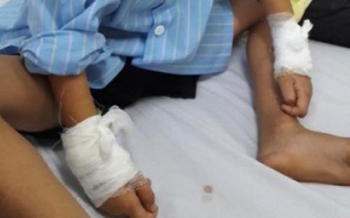 Đình chỉ bác sỹ mổ nhầm tay trẻ 6 tuổi tại Nghệ An. Ảnh: VTV