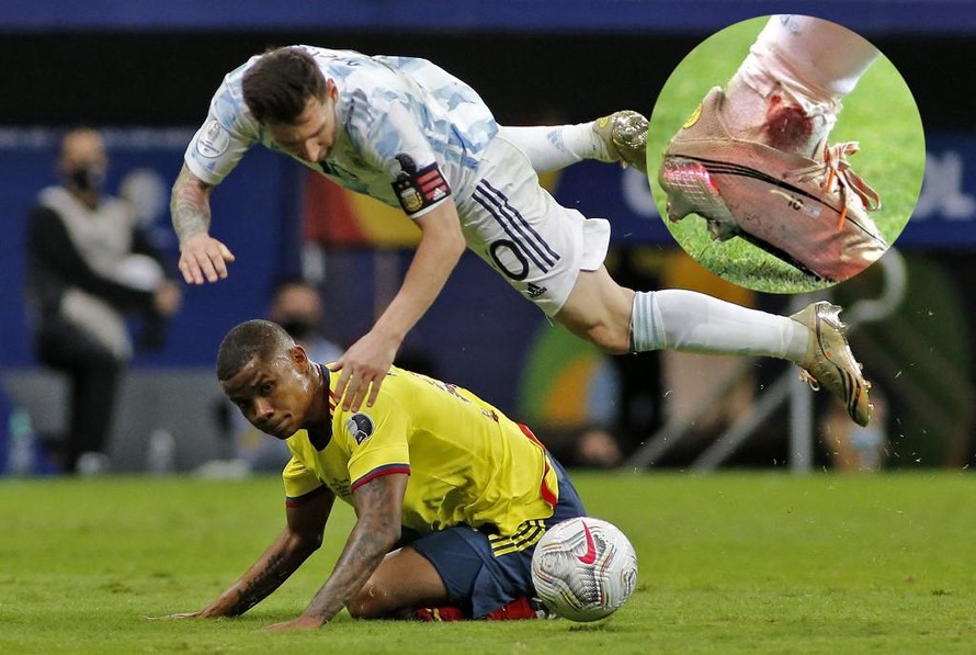 Messi bị đối thủ "chém" tung người và hệ quả là chân chảy máu