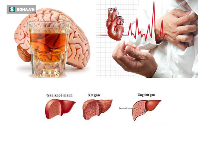 Uống rượu bia thường xuyên: 5 cơ quan nội tạng “bốc hơi” đáng giật mình