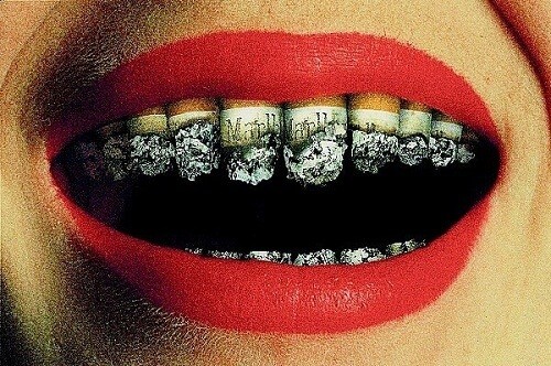 Hút thuốc cũng là nguyên nhân chính gây ra nhiều chứng bệnh về răng miệng