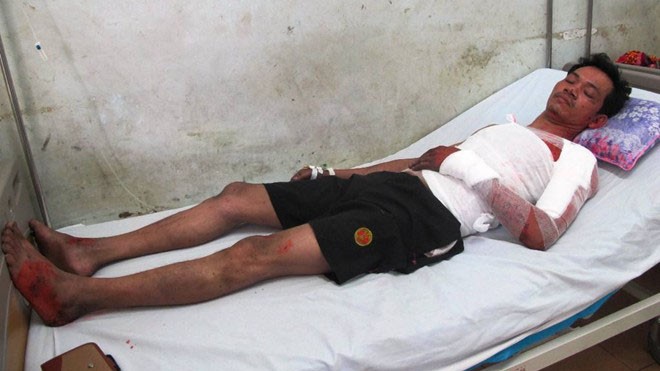 Anh Quang, một trong 5 người bị thương do vụ nổ, hiện điều trị tại bệnh viện đa khoa Nghệ An. Ảnh: Phạm Hòa.