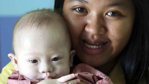 Trong bức ảnh chụp ngày 3/8/2014, sản phụ người Thái là Pattaramon Chanbua, 21 tuổi, chụp cùng với Gammy – cậu bé 9 tháng tuổi sinh ra bị hội chứng Đao tại bệnh viện Sri Racha, tỉnh Chonburi, miền nam Thái Lan. Cặp vợ chồng nhờ Chanbua mang thai hộ đã man