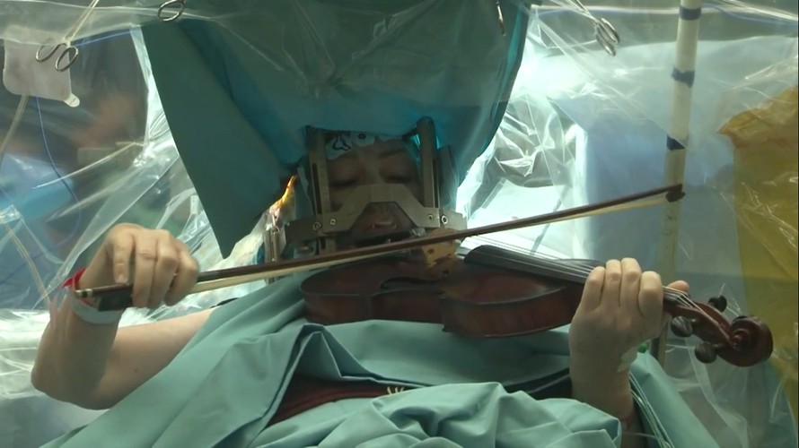 Bệnh nhân chơi đàn trong lúc bác sĩ mổ não