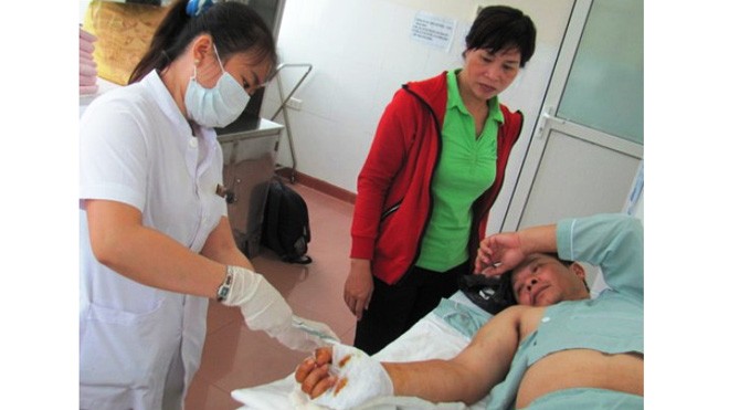 Các bác sĩ Bệnh viện Phong - Da liễu Trung ương Quy Hòa đã nối thành công 4 ngón tay đứt lìa cho bệnh nhân Minh 