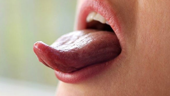 Lưỡi có thể báo hiệu các vấn đề sức khỏe như ho, sốt, vàng da, đau đầu, rối loạn tiêu hóa. Ảnh: ehowcdn