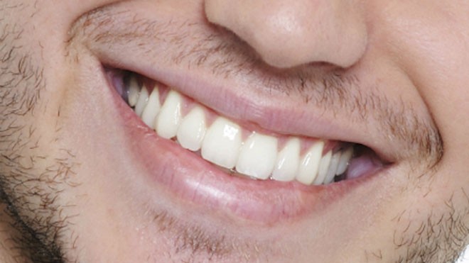 Nam giới thường ít quan tâm đến sức khỏe răng miệng hơn nữ giới. Ảnh minh họa: rudyard