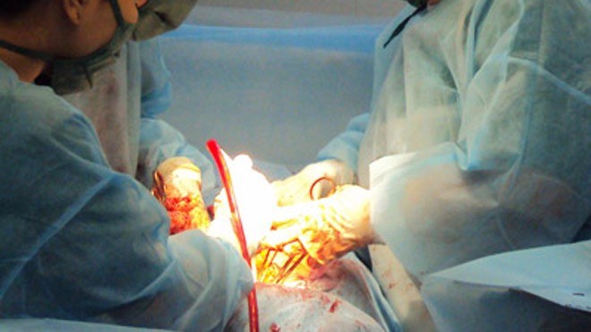 Các bác sĩ thực hiện phẫu thuật, lấy khối u "khủng" cho chị Kha. Ảnh: Lộc Hà