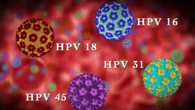 95% các trường hợp ung thư cổ tử cung phát hiện thấy virus HPV. Ảnh minh họa: Doctor.
