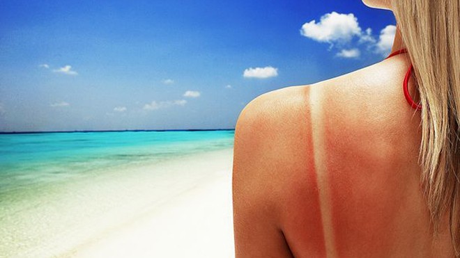 Cách bảo vệ bản thân khỏi ung thư da trong mùa hè