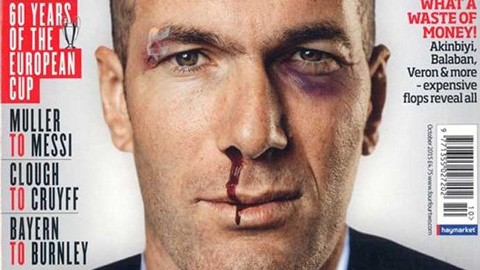 Zidane xuất hiện với bộ dạng khó coi trên trang bìa của tạp chí FourFourTwo