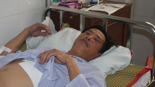 Kỹ sư Tú bị đa chấn thương đang được chữa trị tại bệnh viện. 