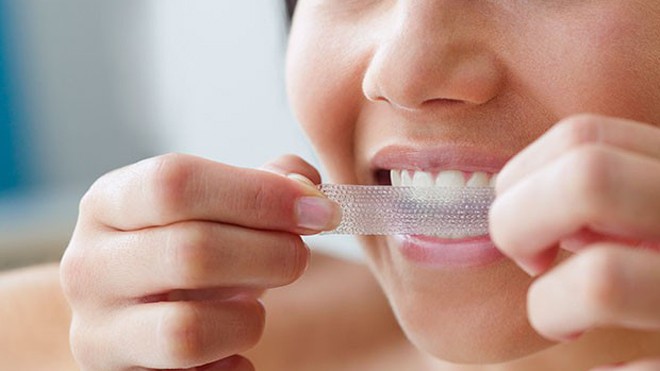 Sử dụng miếng dán trắng răng có thể gây tổn thương nướu. Ảnh: Jose Luis Pelae