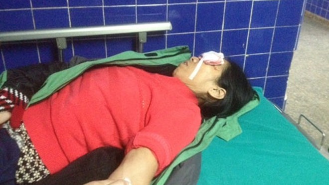 Nạn nhân đang được cấp cứu tại Bệnh viện Hữu nghị Việt Nam-Cuba, Đồng Hới. 
