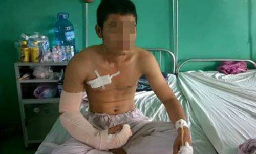 Sức khỏe bệnh nhân Nguyễn Văn Phong đang hồi phục tốt. Ảnh: Khánh Ly/VnExpress