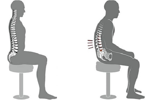 Tư thế ngồi đúng (trái) và sai (phải). Ảnh: Health.