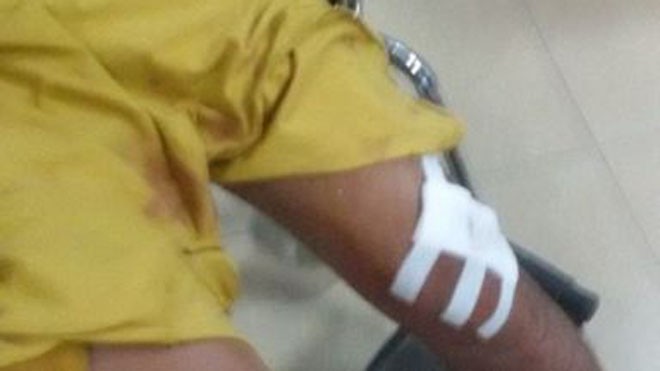 Một nạn nhân bị hung thủ chém vào đầu gối đang được điều trị tại bệnh viện.