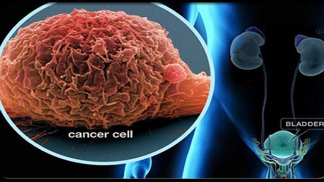 Có những loại thực phẩm càng ăn nhiều sẽ càng nuôi dưỡng tế bào ung thư phát triển.