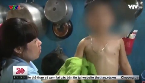 Kinh hãi, bé trai nhập viện vì bị buộc thun vào bộ phận sinh dục