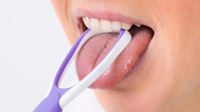 Lưỡi không được làm sạch thường xuyên ngoài việc ảnh hưởng tới vệ sinh răng miệng, làm hơi thở kém thơm tho còn gây nhiều tác hại không ngờ khác cho sức khỏe...Ảnh minh họa