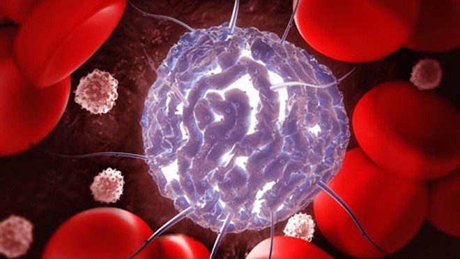Những điều cần biết về ghép tế bào gốc điều trị ung thư máu