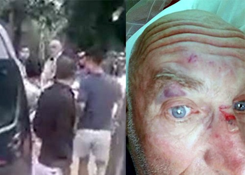 Tin nóng ngày 10/7: Khách Tây bị 5 thanh niên đánh bầm mặt ở Sa Pa 