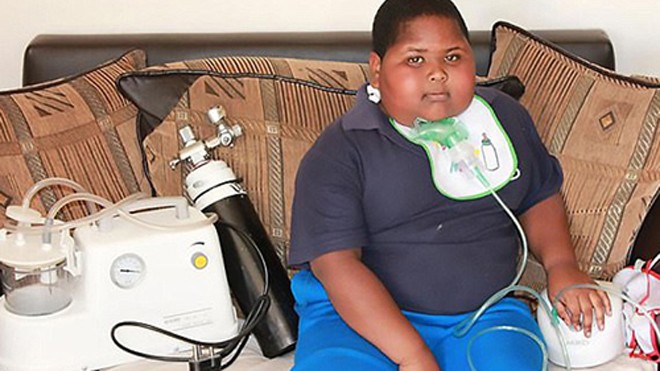 Caden Benjamin, 10 tuổi, mắc hội chứng rối loạn ăn uống hiếm gặp. Ảnh: CEN.