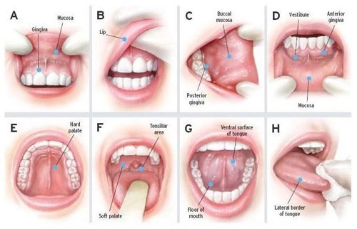 8 bước khám khoang miệng để phát hiện sớm ung thư.
