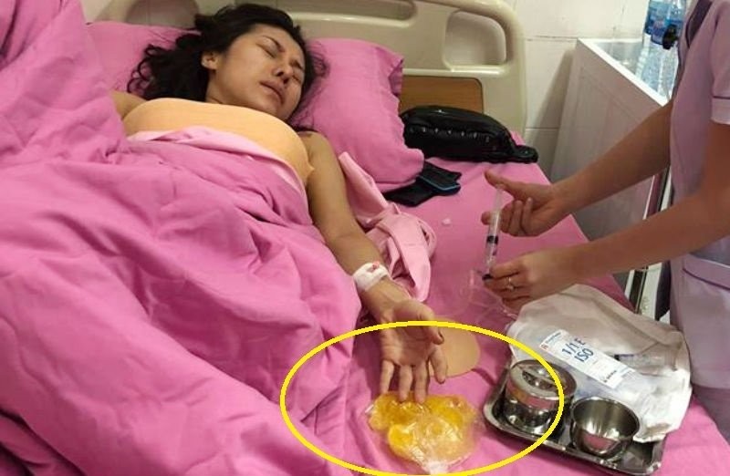 Nữ ca sĩ Mai Tường Vy bị nổ túi ngực sau 7 năm
