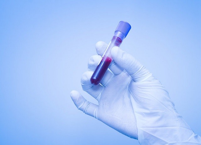 Chỉ cần xét nghiệm máu có thể phát hiện sớm bệnh ung thư? 