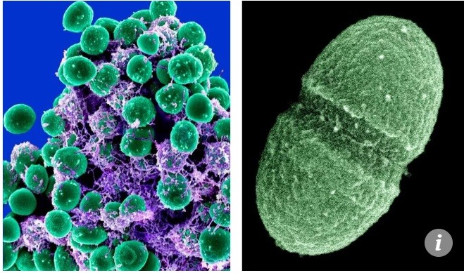 Siêu vi khuẩn MRSA (trái) và siêu vi khuẩn VRE có thể kháng lại các chất cồn xoa tay diệt khuẩn.