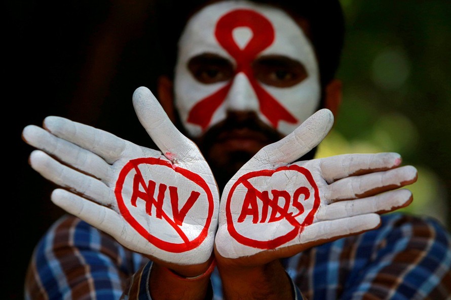Hiện AIDS vẫn là đại dịch toàn cầu và đại dịch này sẽ được đẩy lùi nhờ thuốc kháng virus ART.