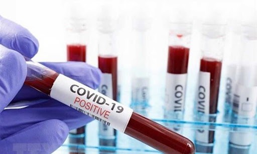 Hàng trăm công ty đang tăng tốc nghiên cứu và phát triển COVID-19.