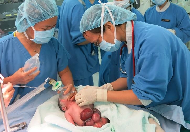 Bé Caroline Trần khi vừa chào đời với toàn bộ nội tạng nằm ngoài ổ bụng
