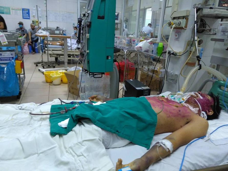 Bệnh nhân Nguyễn T.M đang được điều trị tích cực tại Bệnh viện Bệnh Nhiệt đới Trung ương