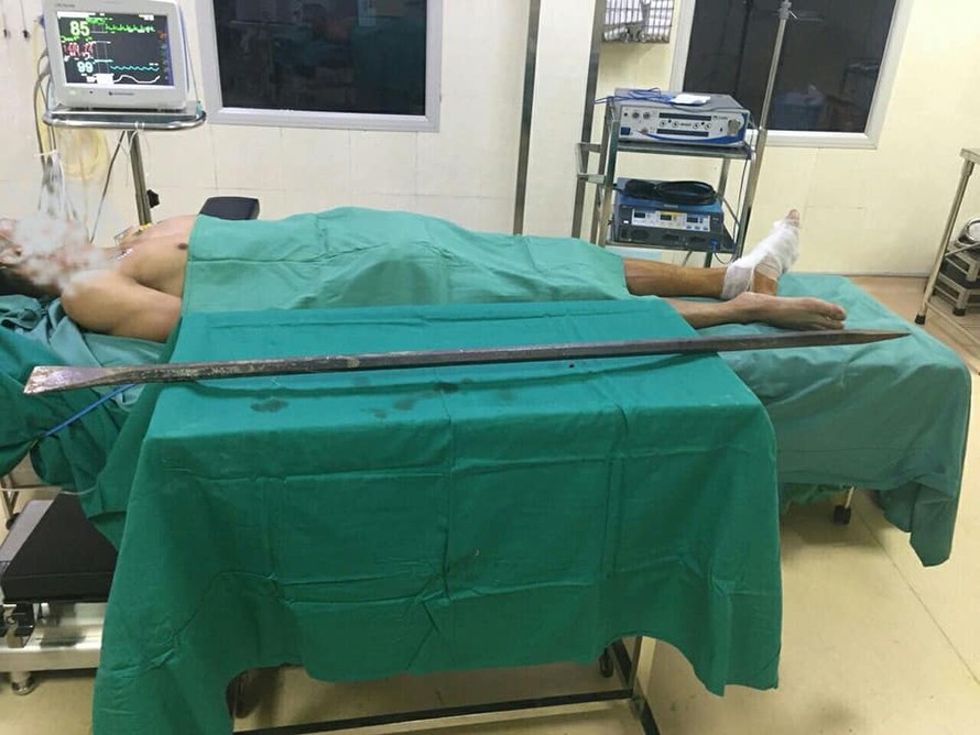  Bệnh nhân và chiếc xà beng đâm xuyên qua chân được các BS Bệnh viện E TƯ phẫu thuật lấy ra khỏi cơ thể.
