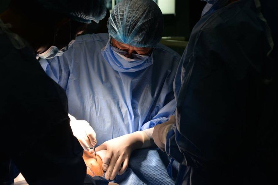 Các BS Bệnh viện Nội tiết đang thực hiện ca phẫu thuật bóc khối bướu khủng lồ cho bệnh nhân N. Ảnh: BV cung cấp
