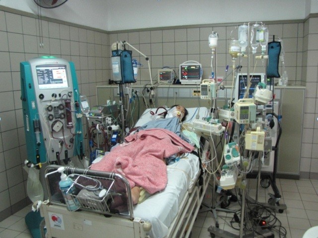 Nhiều bệnh nhân bị viêm cơ tim tối cấp được cứu sống nhờ kỹ thuật ECMO